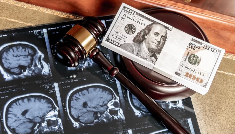 A composite of legal and medical concepts featuring brain MRI images, a gavel, and US currency